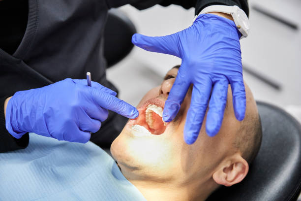 Best Emergency Tooth Extraction in Berry College, GA